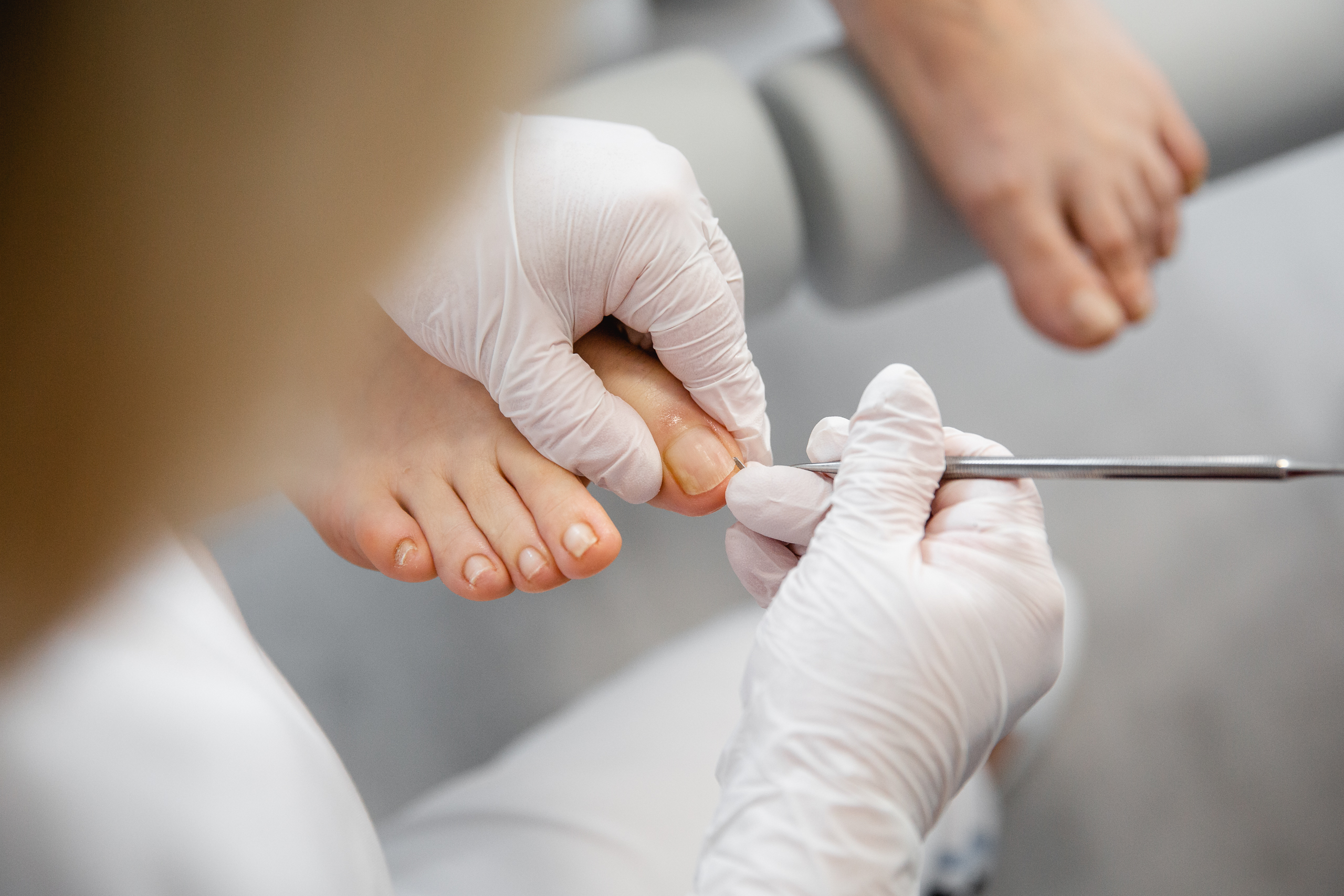 Podologische Komplexbehandlung